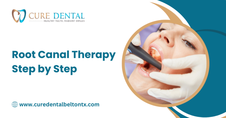 Root Canal Therapy Step By Step Cure Dental