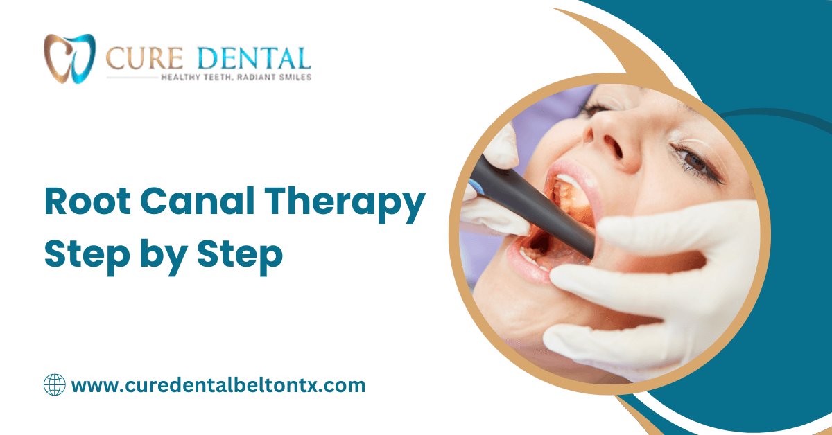 Root Canal Therapy: Step by Step