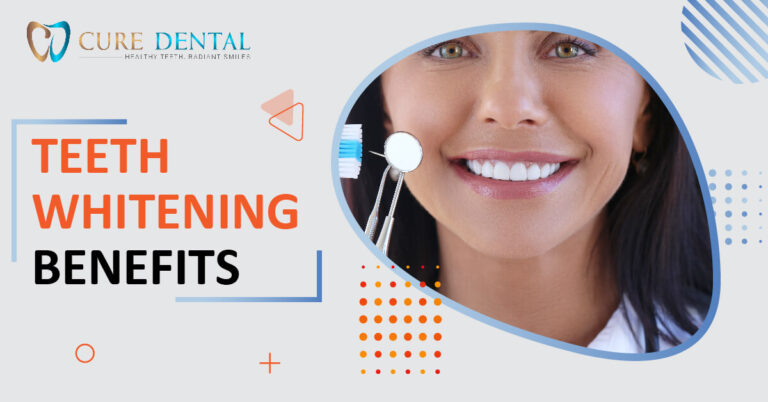 Teeth Whitening Benefits - Cure Dental