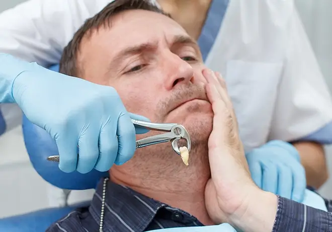 wisdom teeth extraction