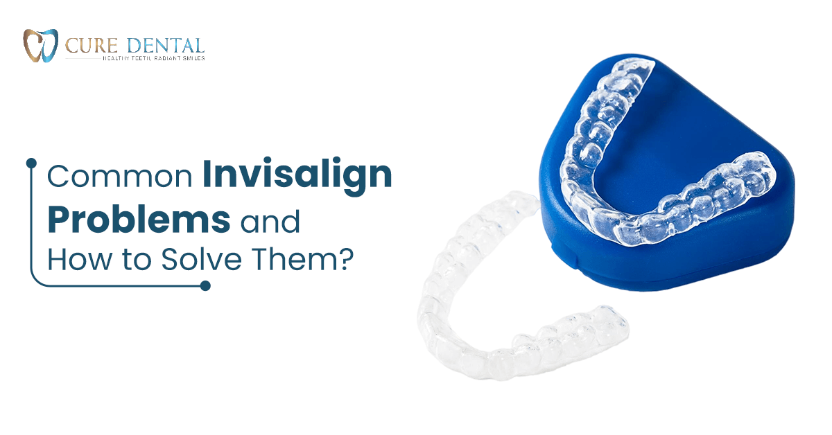 Common Invisalign Problems and How to Solve Them?