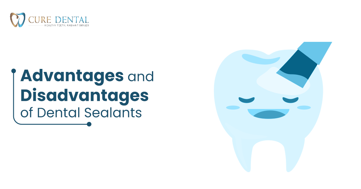 Advantages and Disadvantages of Dental Sealants